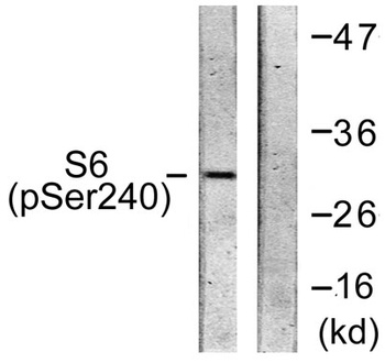Ribosomal Protein S6 (phospho Ser240) rabbit pAb