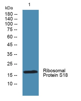 Ribosomal Protein S18 rabbit pAb Antibody