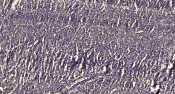 Ribosomal Protein S23 rabbit pAb Antibody