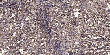 Na+ CP type IVα rabbit pAb Antibody