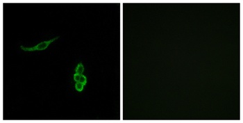 ENaCδ rabbit pAb Antibody