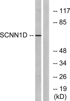 ENaCδ rabbit pAb Antibody