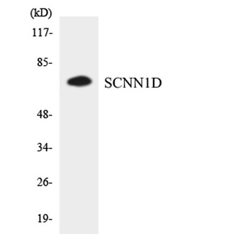 ENaCδ rabbit pAb Antibody