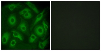 Cadherin-23 rabbit pAb Antibody