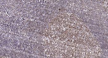 SETMAR rabbit pAb Antibody