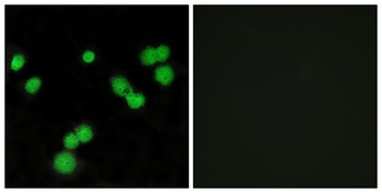 SRp40 rabbit pAb Antibody