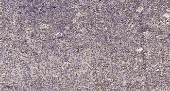 SRp40 rabbit pAb Antibody