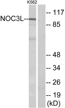 NOC3L rabbit pAb Antibody