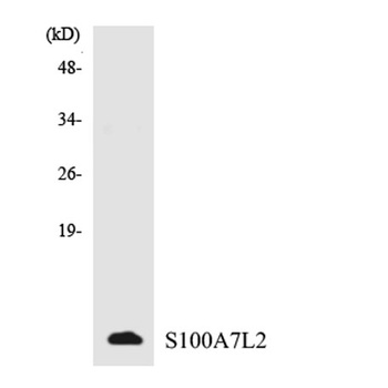S-100A7L2 rabbit pAb Antibody