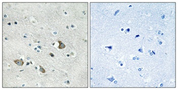 MRP-L32 rabbit pAb Antibody