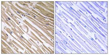 NDRG4 rabbit pAb Antibody