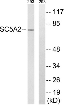 SGLT-2 rabbit pAb Antibody