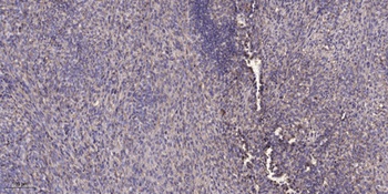 SGLT-2 rabbit pAb Antibody