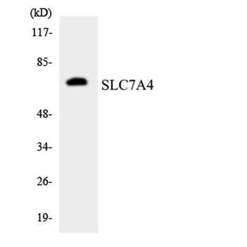 CAT-4 rabbit pAb Antibody