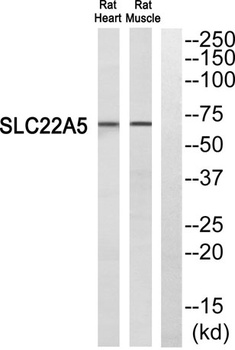 OCTN2 rabbit pAb Antibody