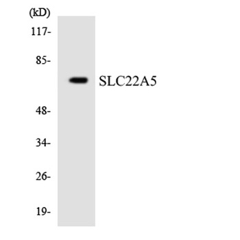 OCTN2 rabbit pAb Antibody