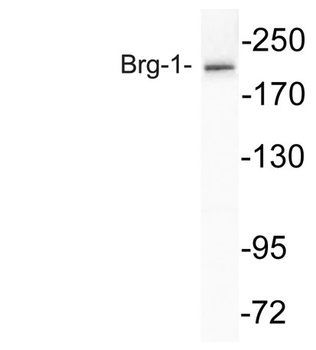 Brg-1 rabbit pAb Antibody