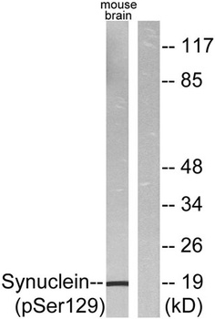 Synuclein-α (phospho Ser129) rabbit pAb Antibody