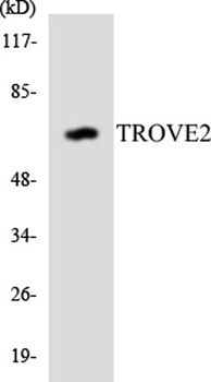 RO60 rabbit pAb Antibody