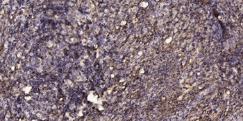 RO60 rabbit pAb Antibody