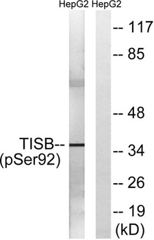 TIS11B (phospho Ser92) rabbit pAb Antibody