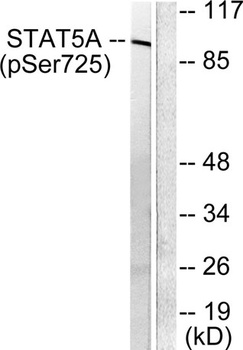 Stat5a/b (phospho Ser726/731) rabbit pAb