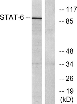 Stat6 rabbit pAb