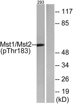Krs-1/2 (phospho Thr183) rabbit pAb