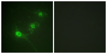 LKB1 (phospho Ser428) rabbit pAb