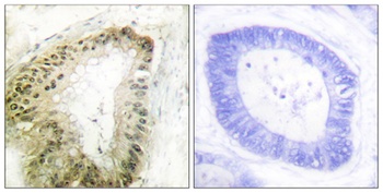 LKB1 (phospho Ser428) rabbit pAb