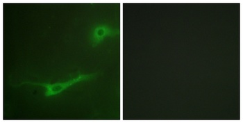 Unc18-1 rabbit pAb Antibody