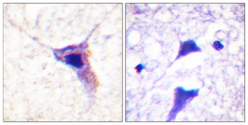 Synapsin I (phospho Ser62) rabbit pAb