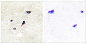Synapsin I (phospho Ser605) rabbit pAb