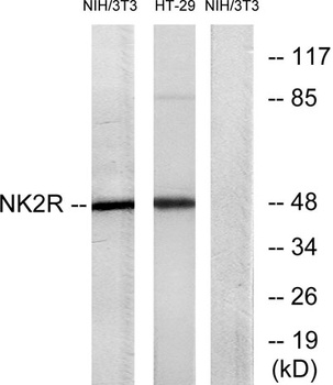 NK-2R rabbit pAb Antibody