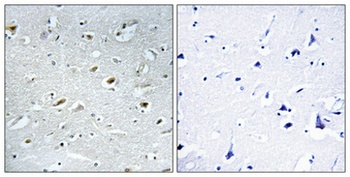 TACC1 rabbit pAb Antibody