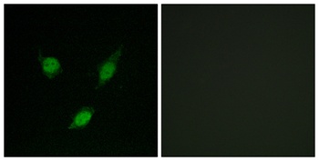 TACC1 rabbit pAb Antibody
