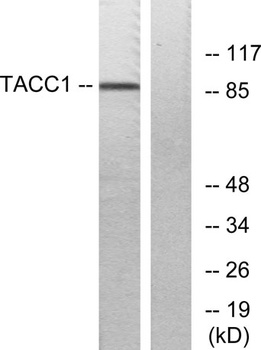 TACC1 rabbit pAb Antibody