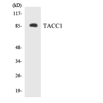 TACC1 rabbit pAb Antibody