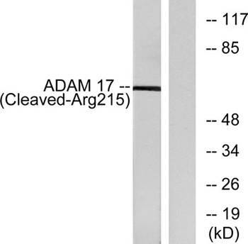 Cleaved-TACE (R215) rabbit pAb Antibody