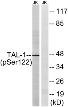 TAL1 (phospho Ser122) rabbit pAb Antibody