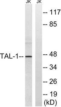 TAL1 rabbit pAb Antibody