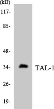 TAL1 rabbit pAb Antibody