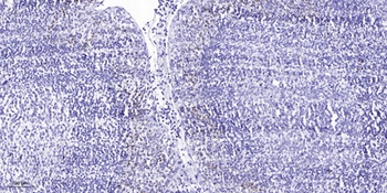 TAL1 rabbit pAb Antibody