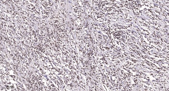 TEF-1 rabbit pAb Antibody