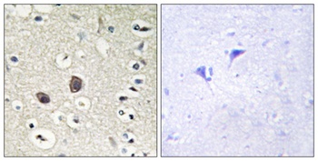 Tie-2 rabbit pAb Antibody