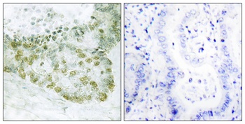 Hic-5 rabbit pAb Antibody