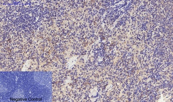 TGFβ RI (phospho Ser165) rabbit pAb