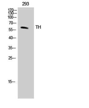 Tyrosine Hydroxylase rabbit pAb Antibody