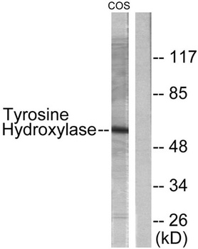 Tyrosine Hydroxylase rabbit pAb Antibody