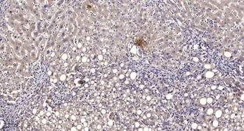 PBR rabbit pAb Antibody